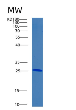 Recombinant Human BNIP1 Protein