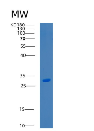 Recombinant Human BSND Protein