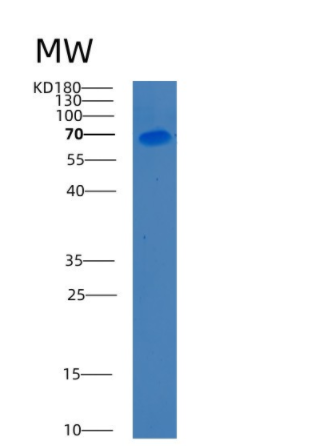 Recombinant Human C9 Protein