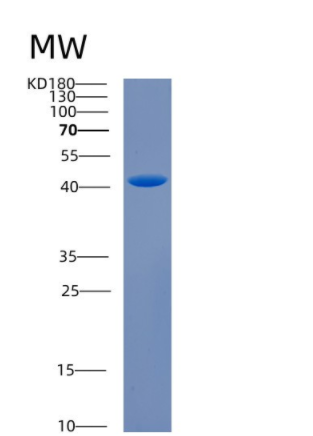 Recombinant Human CAB39 Protein