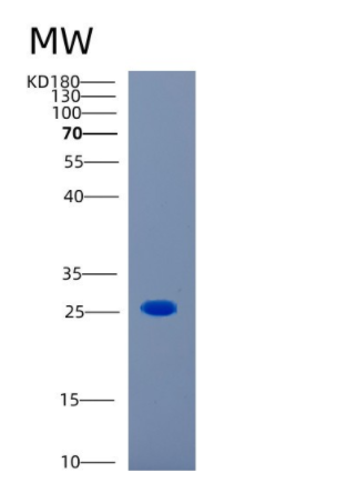 Recombinant Human CAPSL Protein