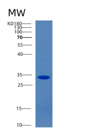 Recombinant Human CAPZA2 Protein
