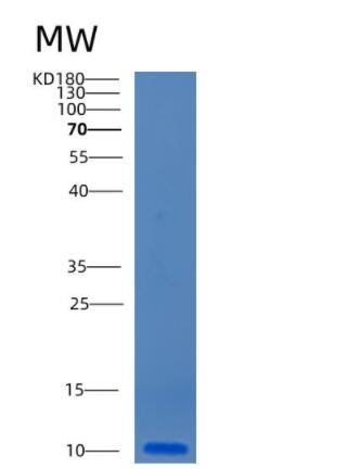 Recombinant Human CCL18 Protein