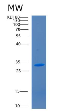 Recombinant Human CD1A Protein