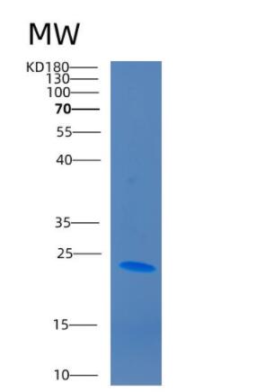 Recombinant Human CD2 Protein