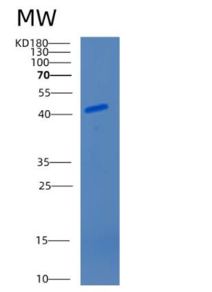 Recombinant Mouse Cathepsin E Protein