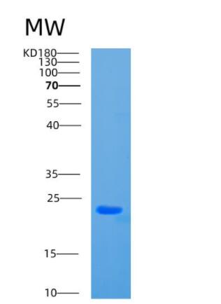 Recombinant Human CBX3 Protein