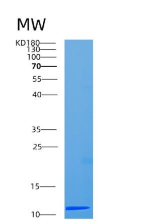 Recombinant Human CCDC23 Protein