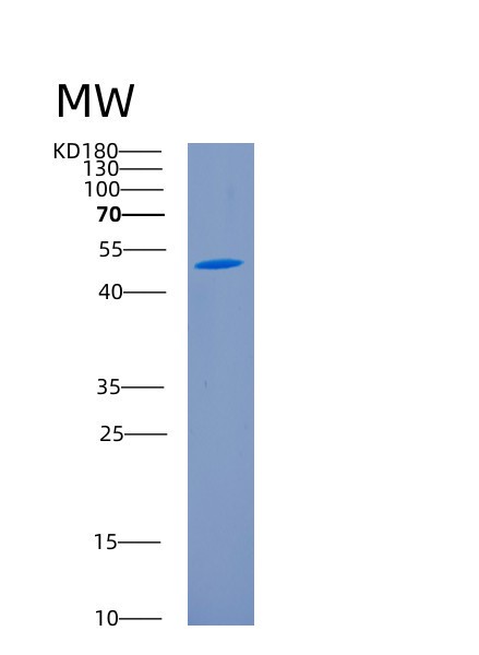 Recombinant Human CD226 Protein