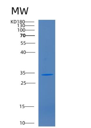 Recombinant Human CD1B Protein