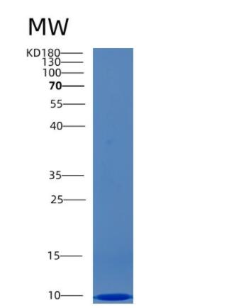 Recombinant Human CCL4L1 Protein
