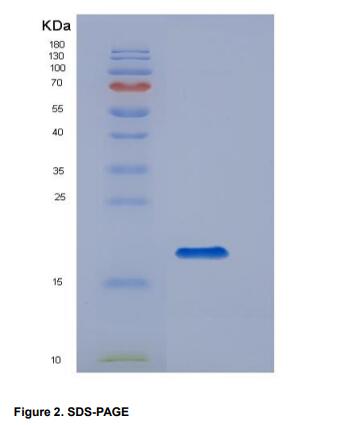 Recombinant Cluster Of Differentiation 14 (CD14)