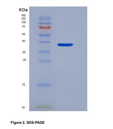 Recombinant Programmed Cell Death Protein 1 Ligand 1 (PDL1)
