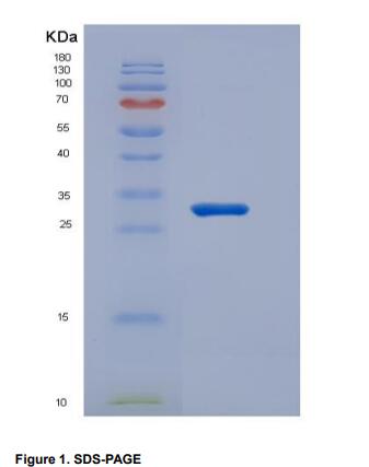 Recombinant Cluster Of Differentiation 226 (CD226)
