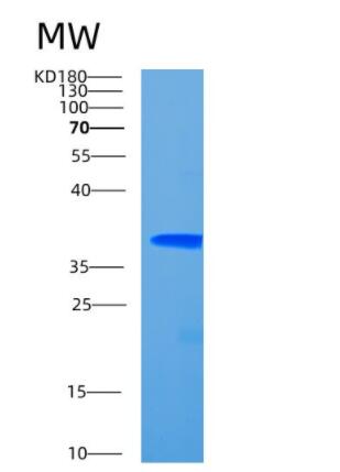 Recombinant Human CCDC69 Protein