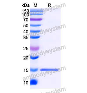 Anti-SARS-CoV-2 S Protein Nanobody (SAA0970)