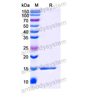 Anti-Human CD126/IL6R/IL-6RA Nanobody (SAA1278)