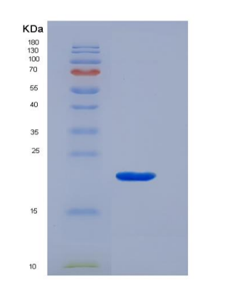 Recombinant T-Cell Surface Glycoprotein CD3 Gamma (CD3g)