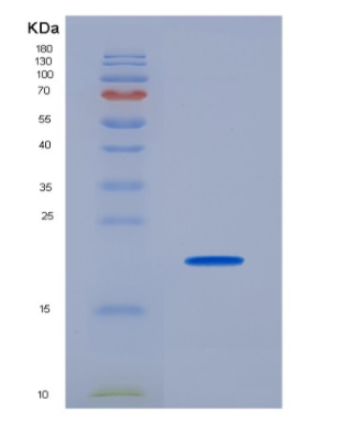 Recombinant Cluster Of Differentiation 74 (CD74)
