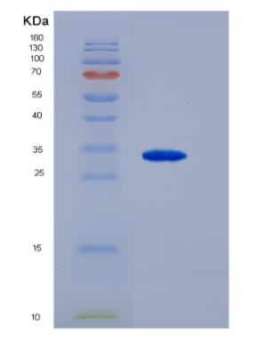 Eukaryotic Cluster of Differentiation 79B (CD79B)