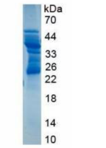 Recombinant Cluster Of Differentiation 83 (CD83)
