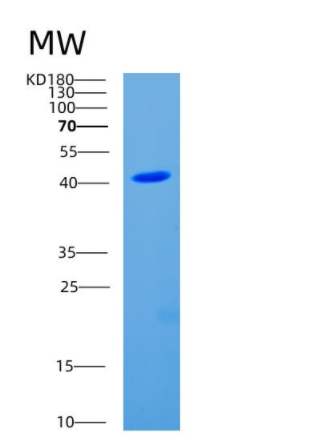 Recombinant Human CDC123 Protein