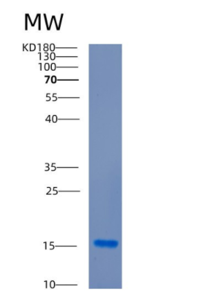 Recombinant Human CDK2AP2 Protein