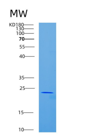 Recombinant Human CD84 Protein