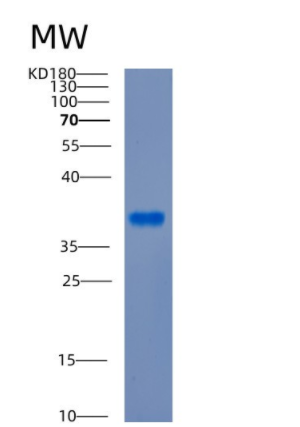 Recombinant Human CDK3 Protein