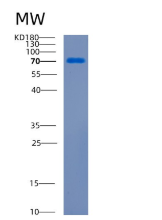 Recombinant Human CDCP1 Protein