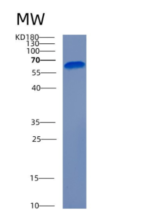 Recombinant Human CECR1 Protein