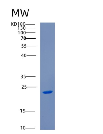 Recombinant Human CENPM Protein
