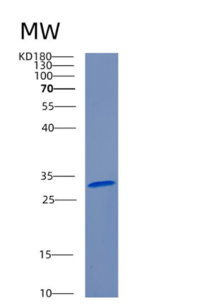 Recombinant Human CERT Protein