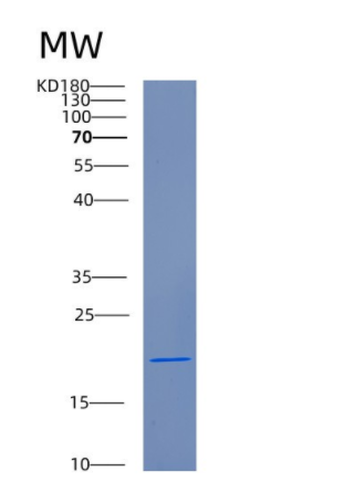 Recombinant Human CFL2 Protein