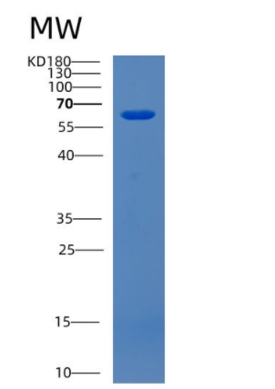 Recombinant Human CDK5RAP3 Protein