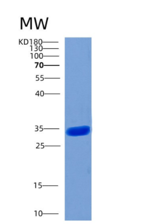 Recombinant Human CHIP Protein