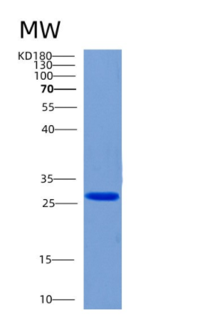 Recombinant Human CHMP6 Protein