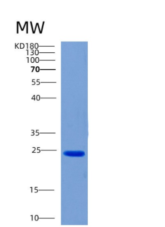 Recombinant Human CHODL Protein