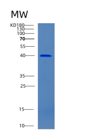 Recombinant Human CIAO1 Protein