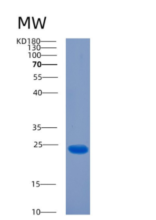 Recombinant Human CIB2 Protein