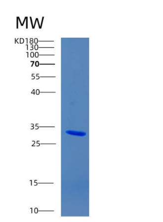 Recombinant Human CHRNA6 Protein