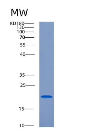 Recombinant Human CIRBP Protein