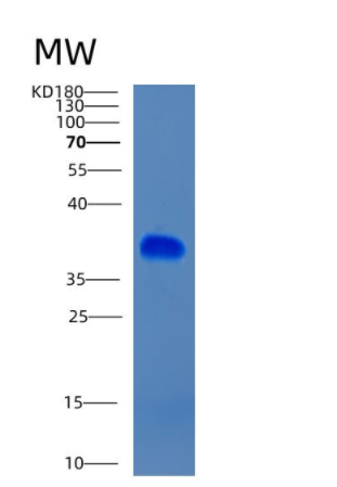 Recombinant Human CIAPIN1 Protein