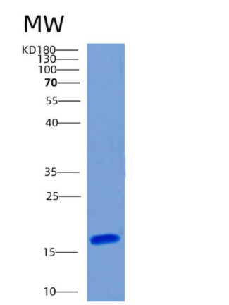 Recombinant Human CHRAC1 Protein