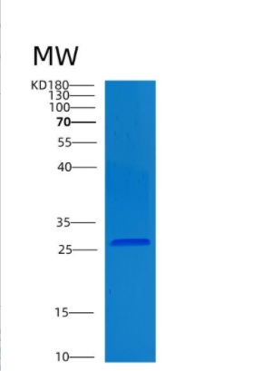 Recombinant Human CLNS1A Protein