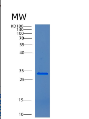Recombinant Human CNN1 Protein