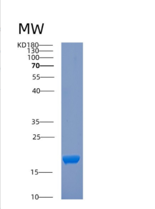 Recombinant Human COTL1 Protein