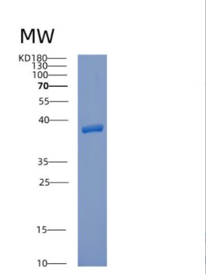 Recombinant Human CPPED1 Protein