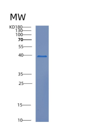 Recombinant Human CREBZF Protein
