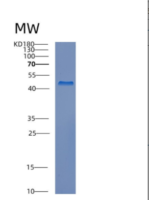 Recombinant Human CREB3L2 Protein